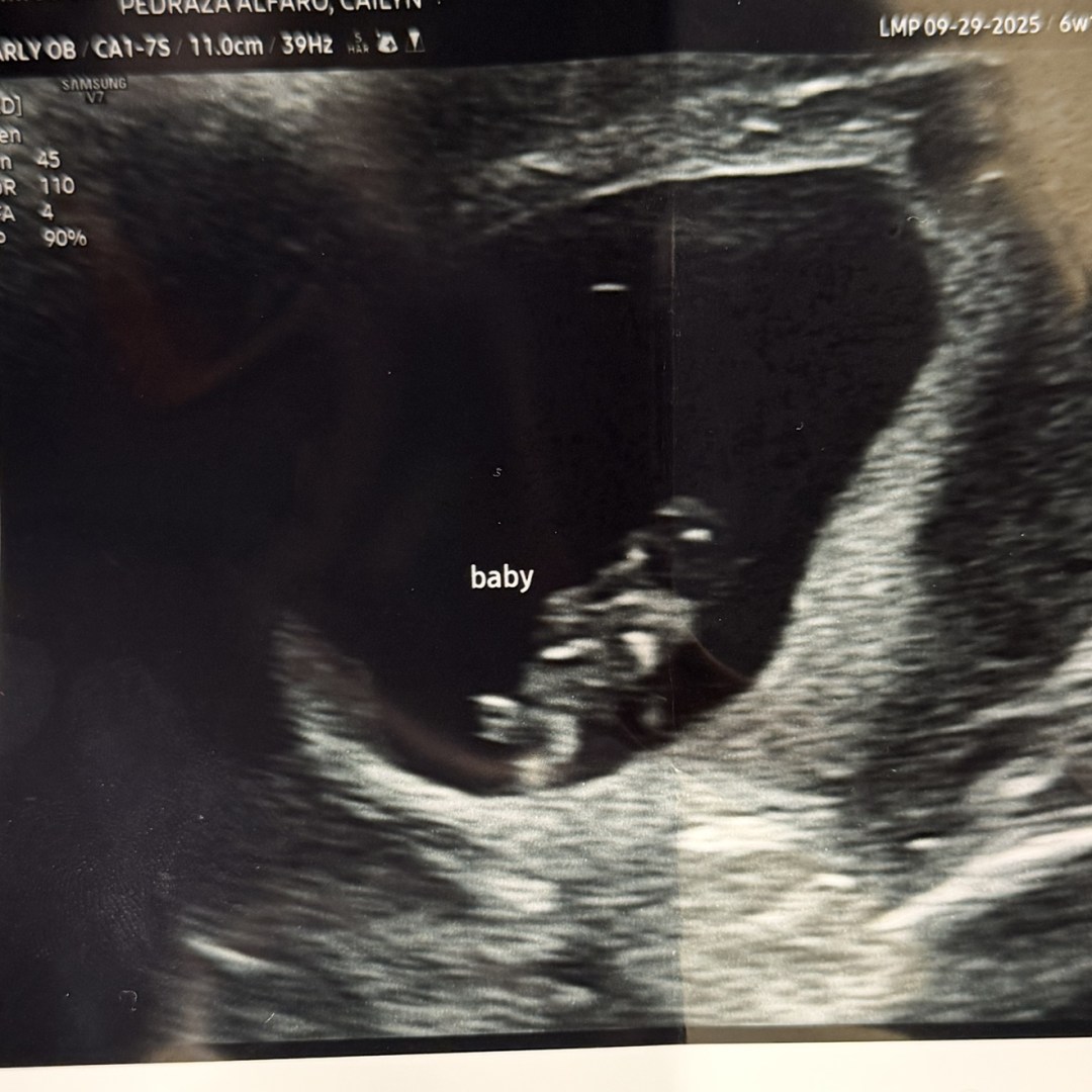 Photo shared by Cailyn for their Babylist baby registry.