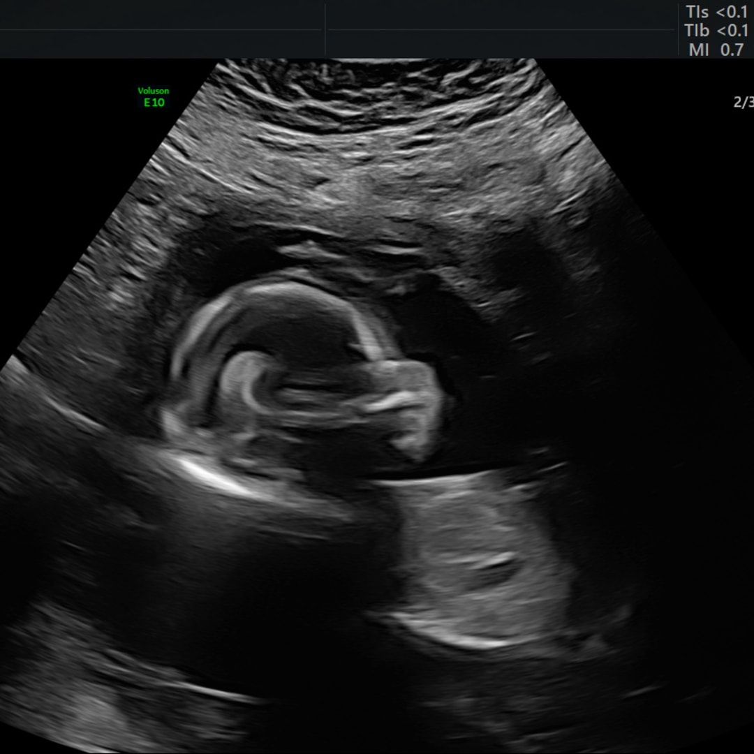 Photo shared by Moira for their Babylist baby registry.