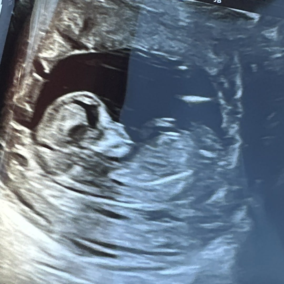 Photo shared by Angelina for their Babylist baby registry.