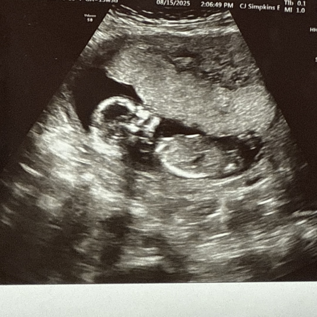 Photo shared by Lauren for their Babylist baby registry.