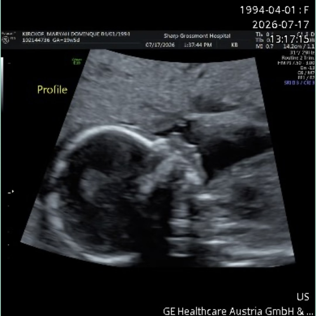 Photo shared by Maryah for their Babylist baby registry.