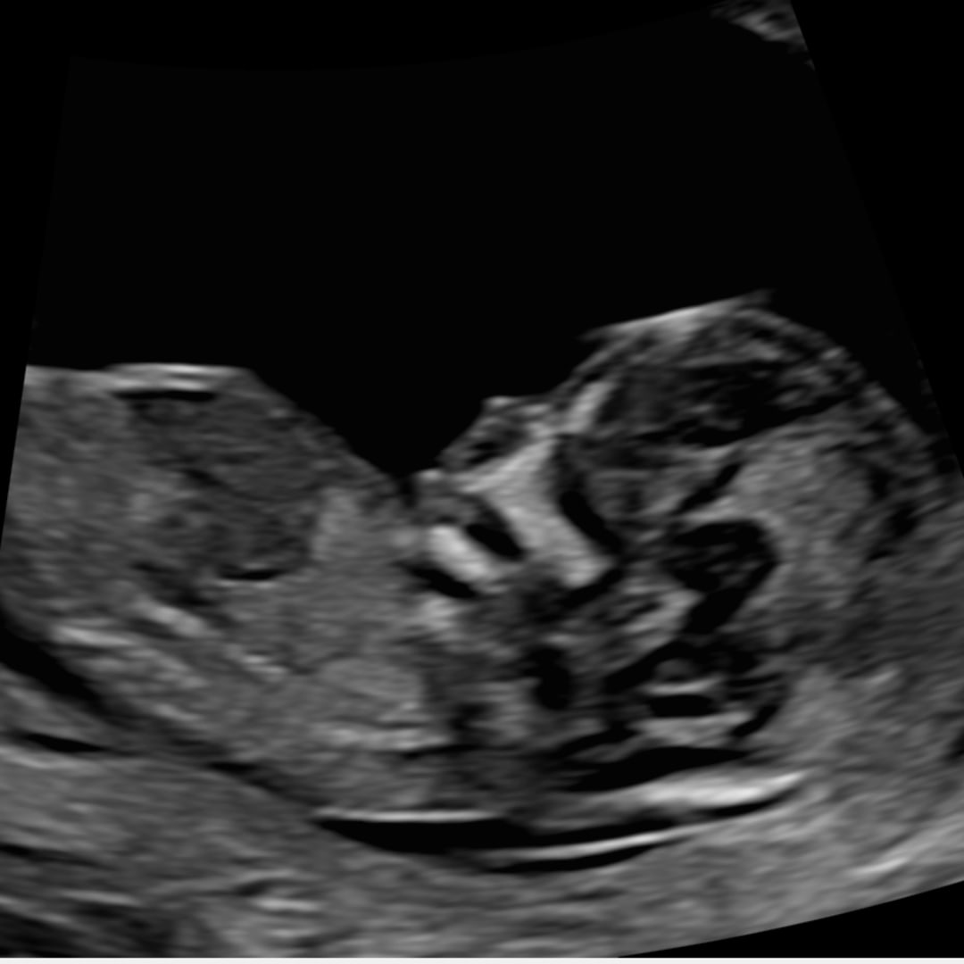 Photo shared by Allison for their Babylist baby registry.