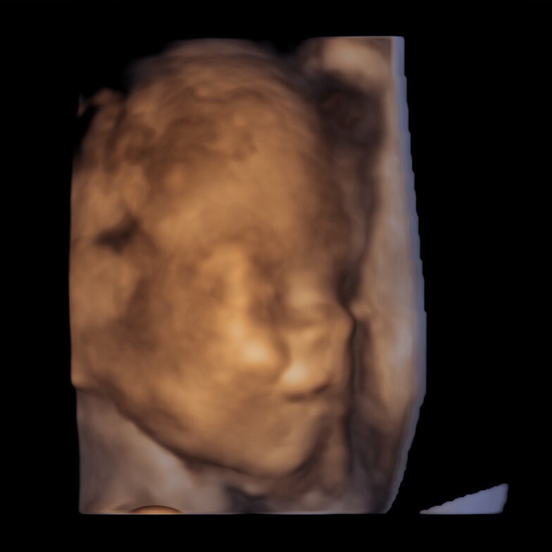 Photo shared by Ava for their Babylist baby registry.
