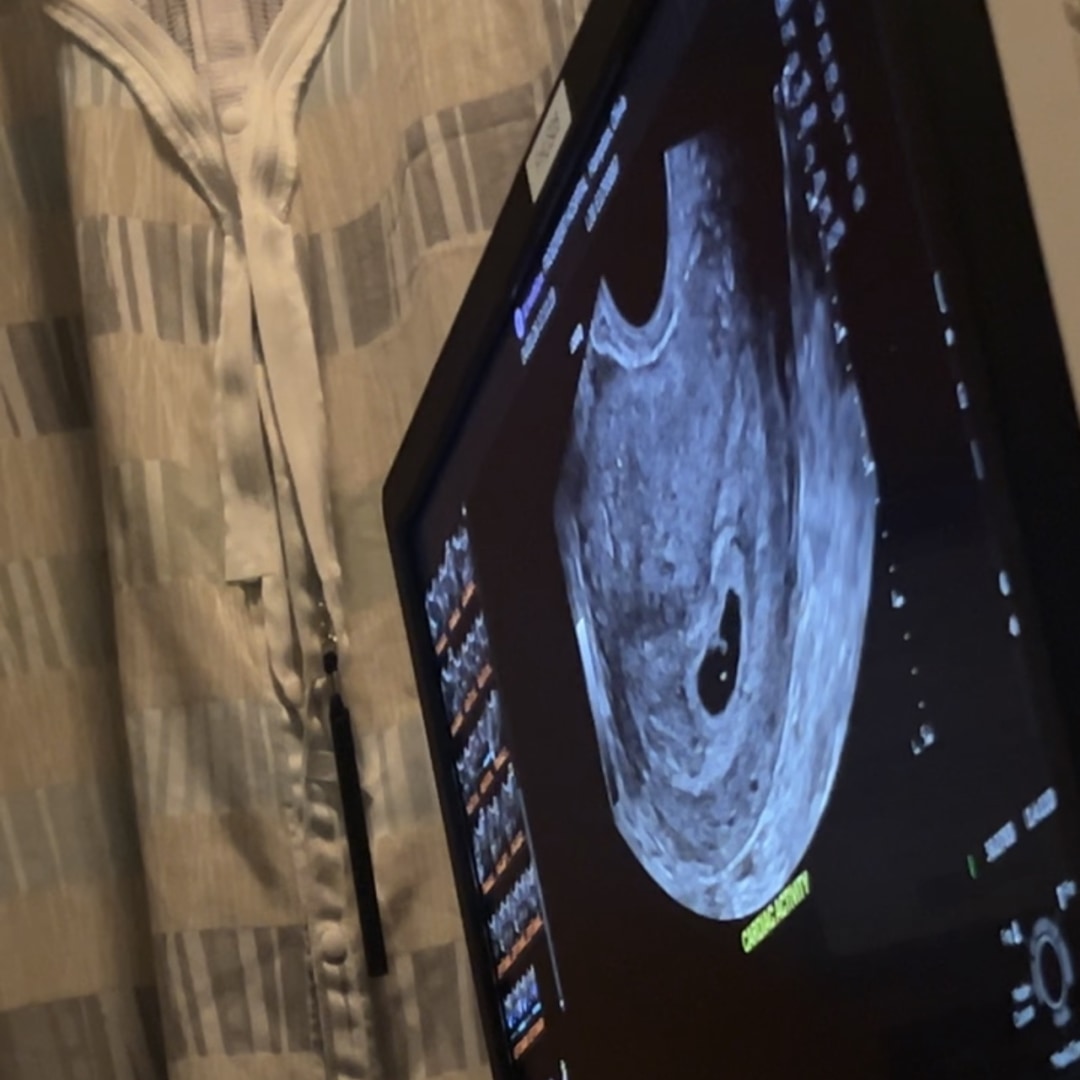 Photo shared by Olivia for their Babylist baby registry.