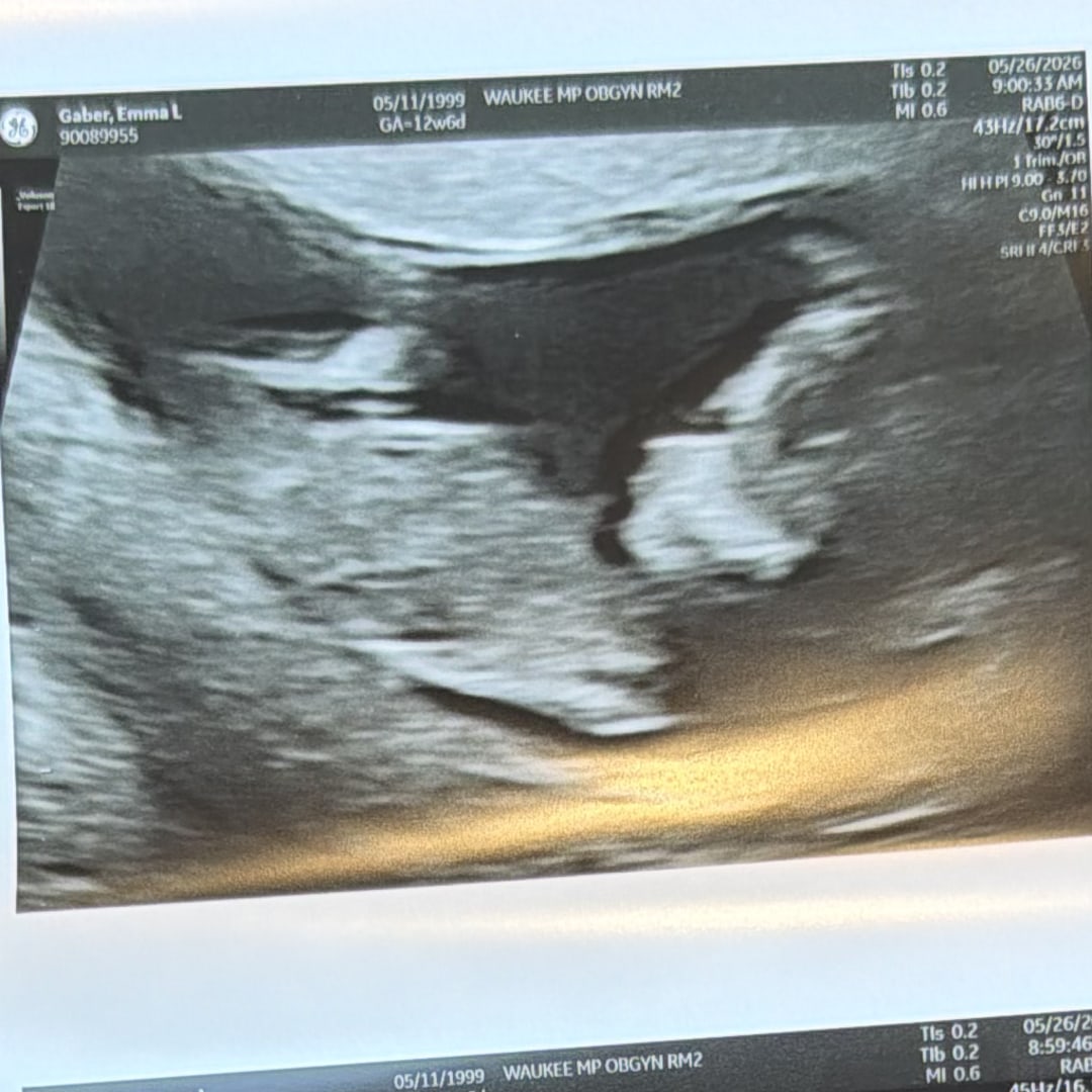 Photo shared by Emma for their Babylist baby registry.
