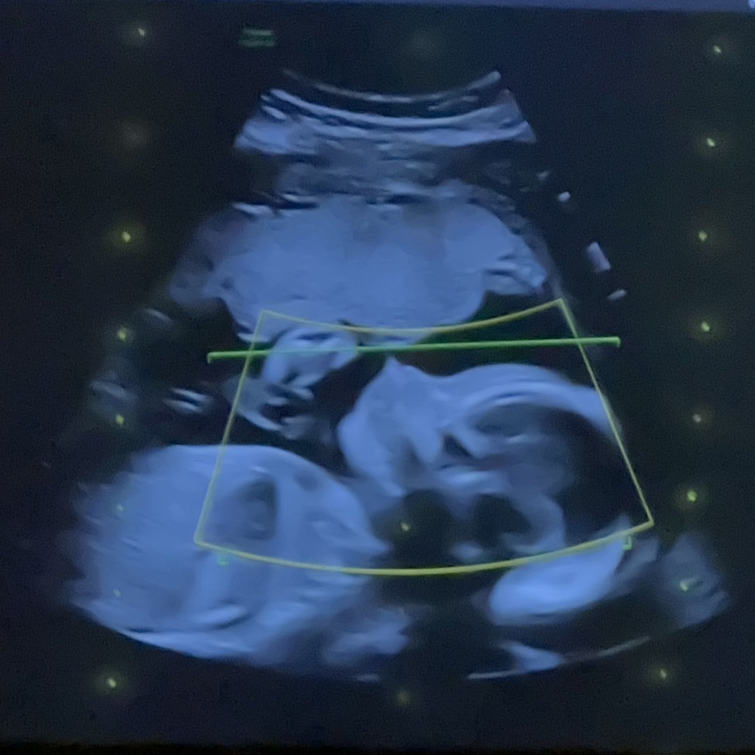 Photo shared by Sidonia for their Babylist baby registry.