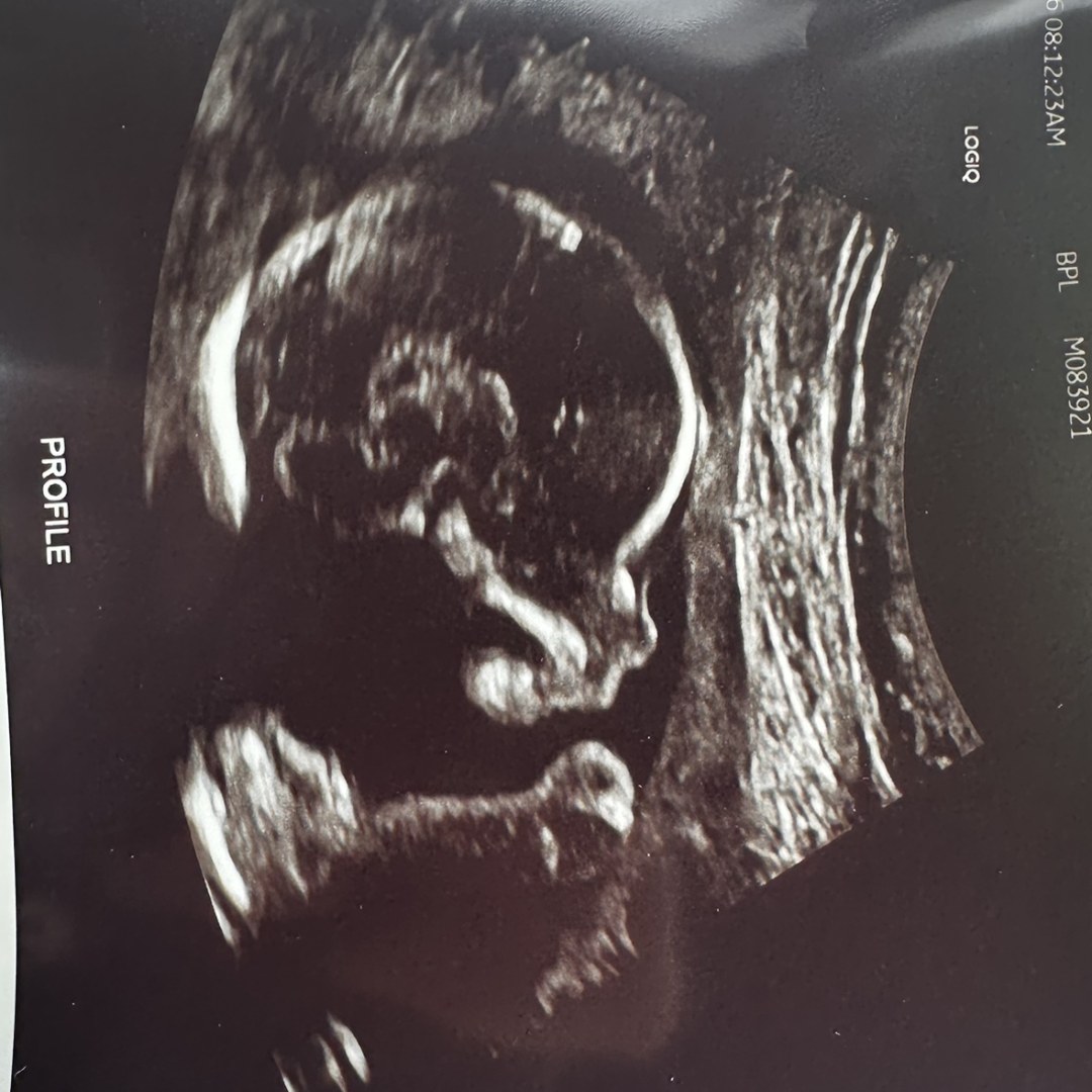 Photo shared by Alexis for their Babylist baby registry.