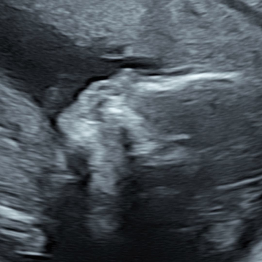Photo shared by Erik for their Babylist baby registry.