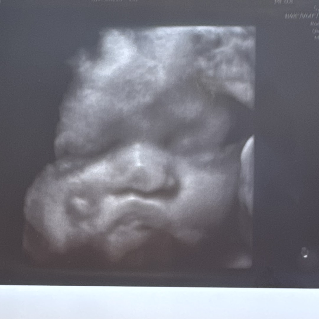 Photo shared by Najah for their Babylist baby registry.