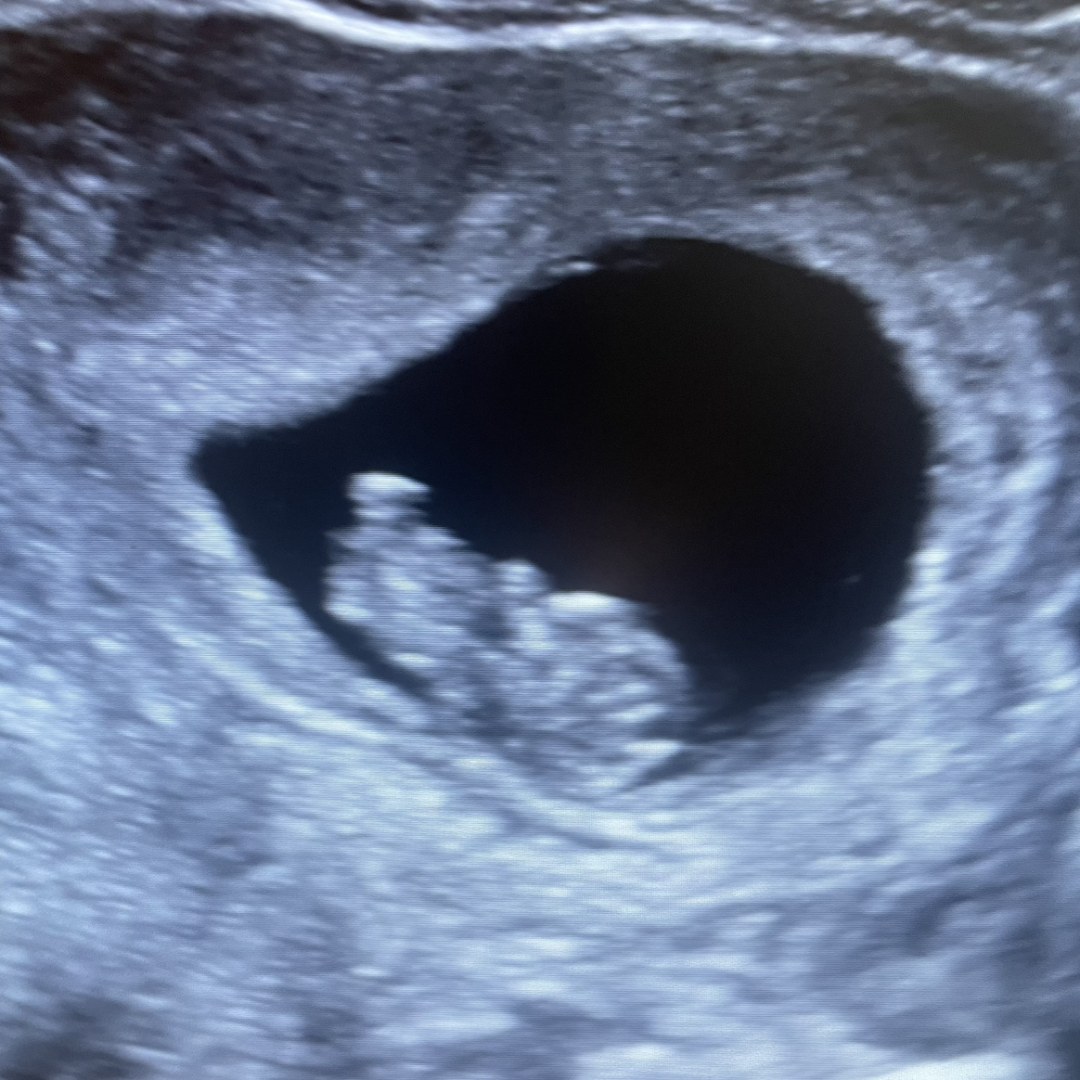 Photo shared by Savannah for their Babylist baby registry.