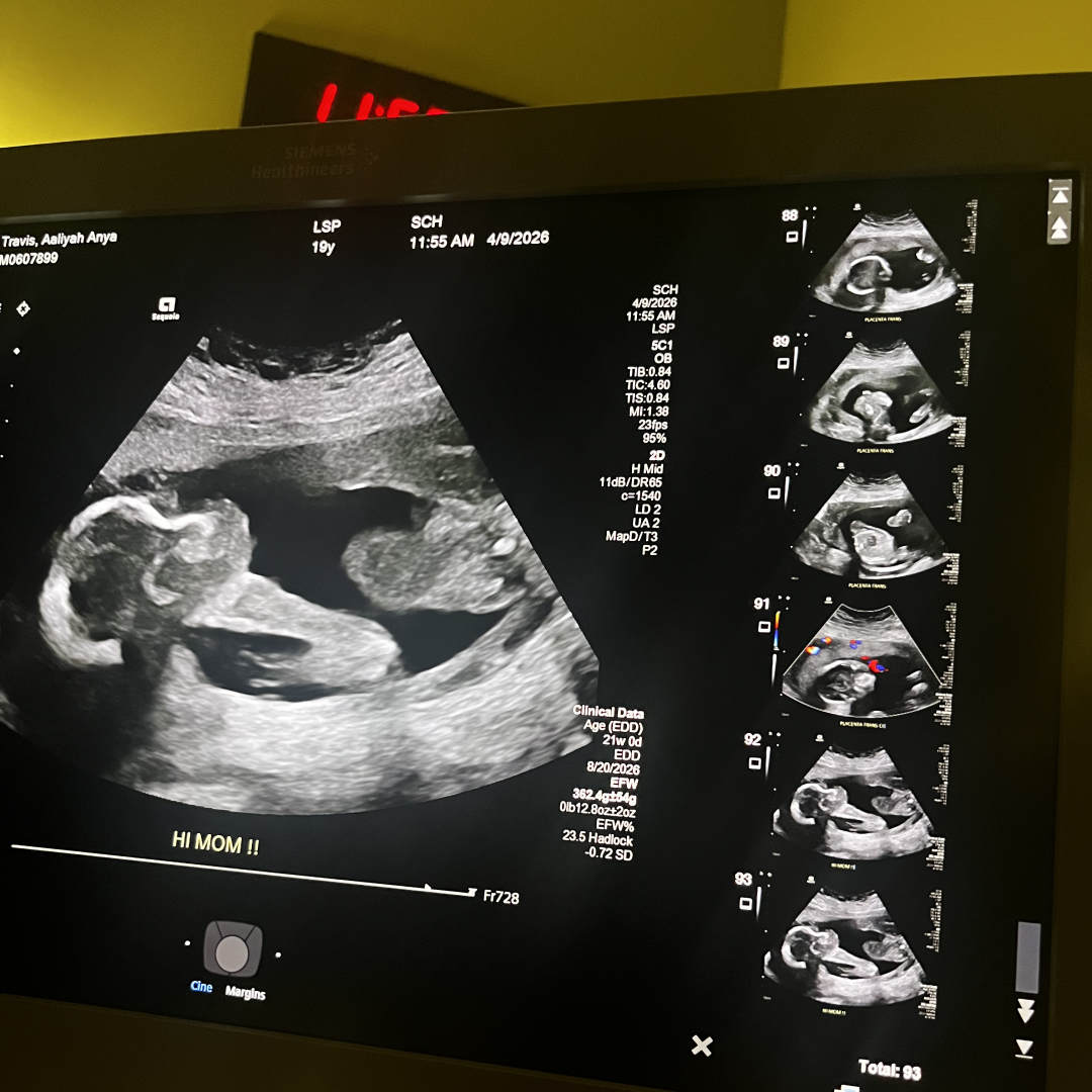 Photo shared by Aaliyah for their Babylist baby registry.