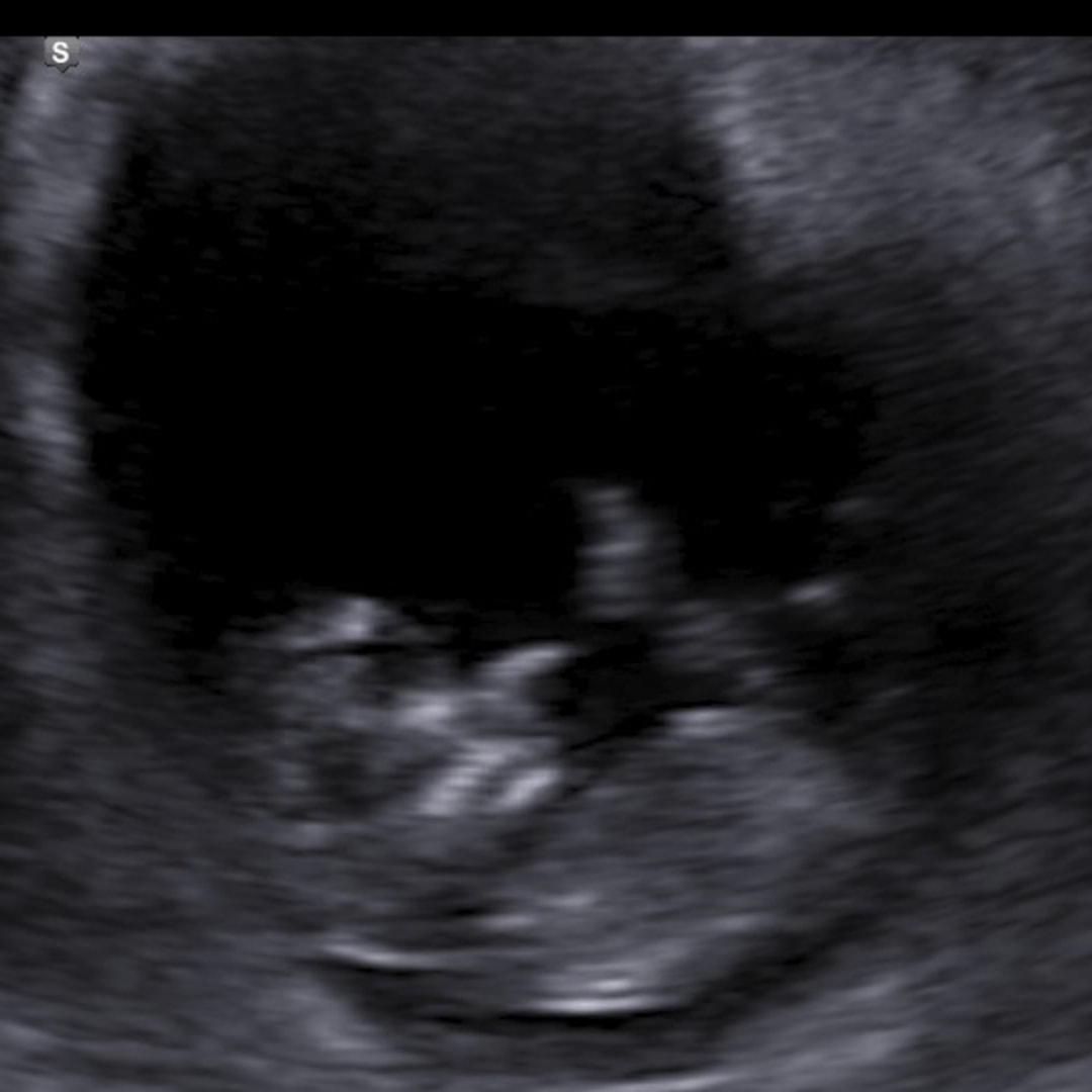Photo shared by Cecia for their Babylist baby registry.