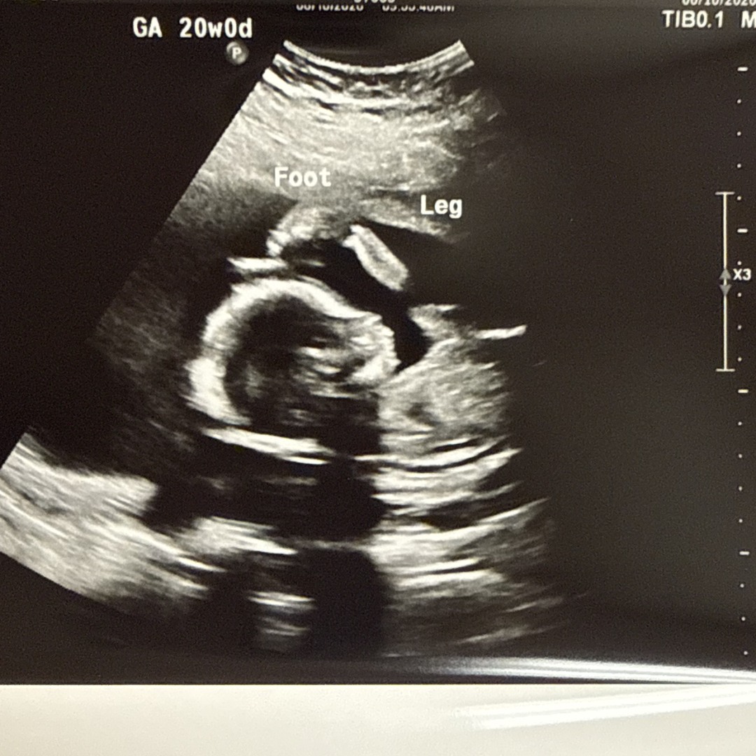 Photo shared by Patience for their Babylist baby registry.