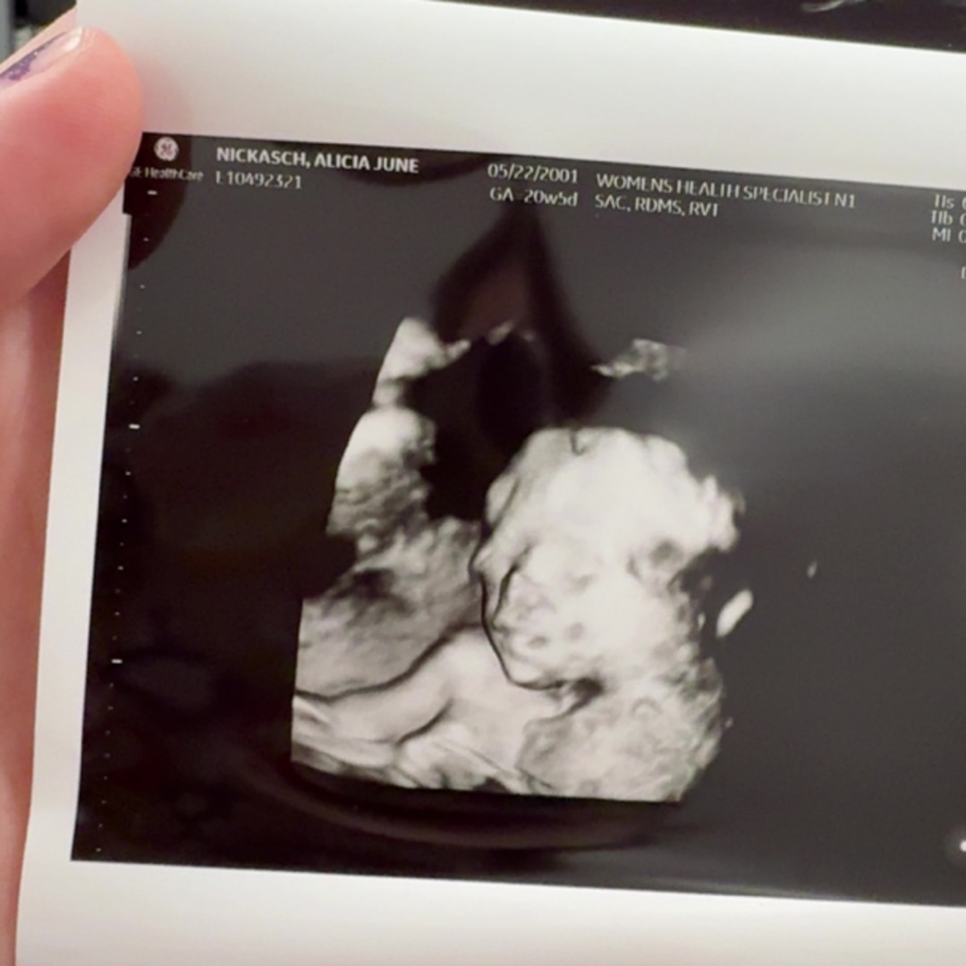 Photo shared by Alicia for their Babylist baby registry.