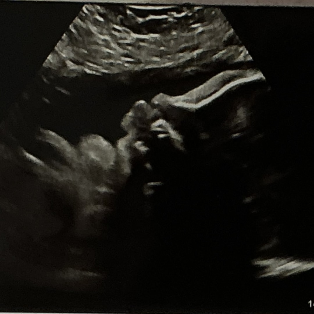 Photo shared by IvyRose for their Babylist baby registry.