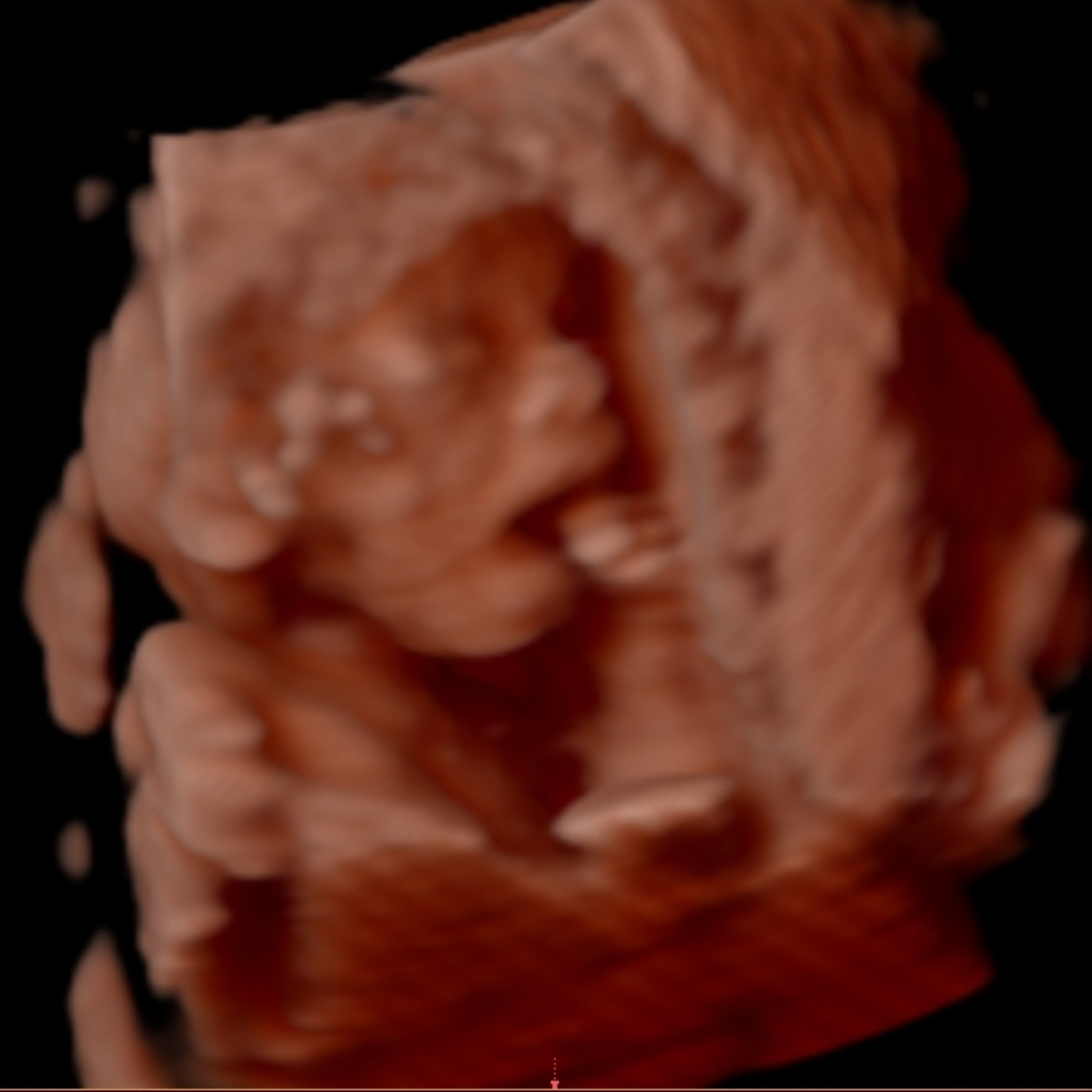 Photo shared by Kyra for their Babylist baby registry.