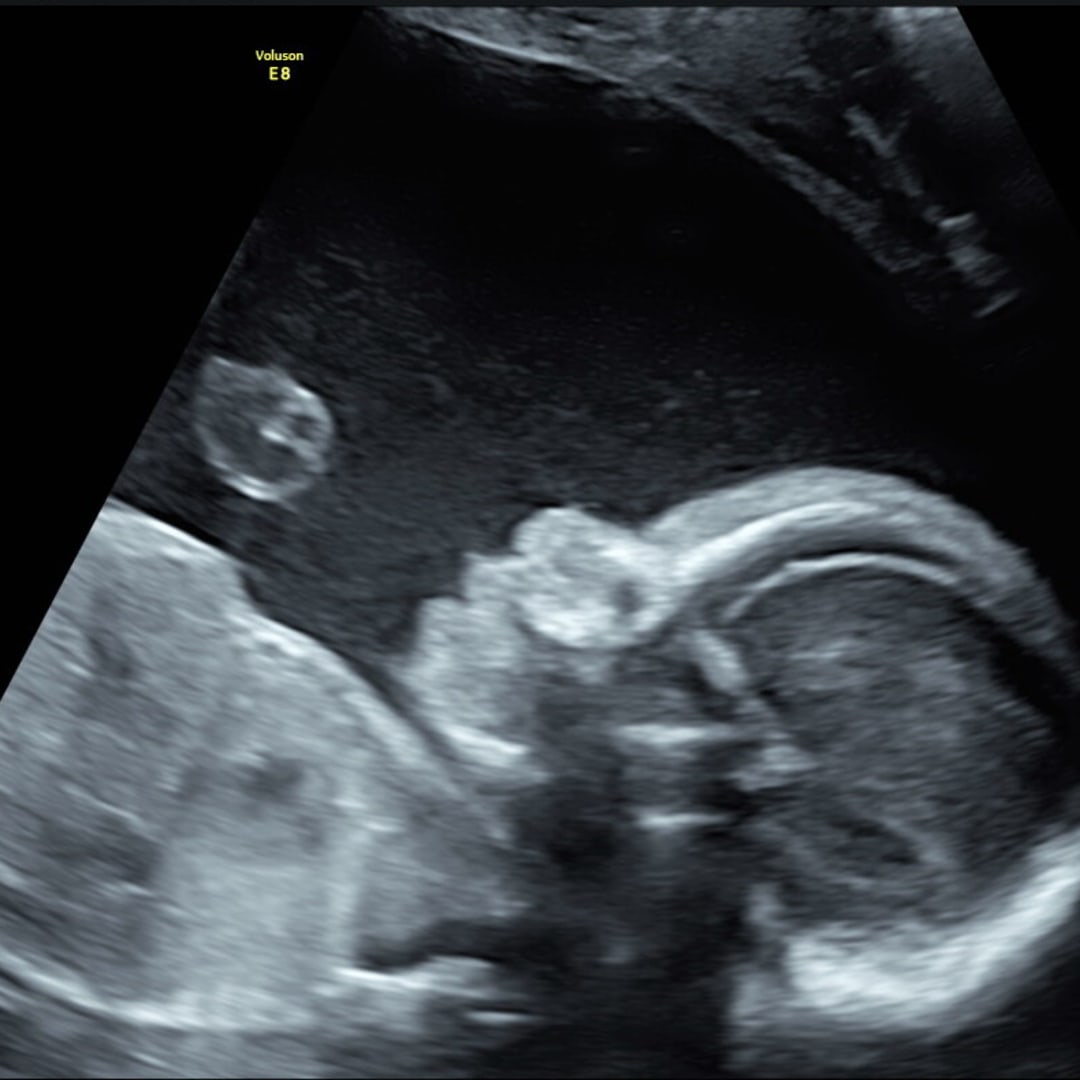 Photo shared by Jae for their Babylist baby registry.