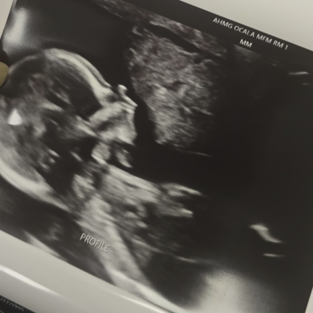 Photo shared by Lilybel for their Babylist baby registry.