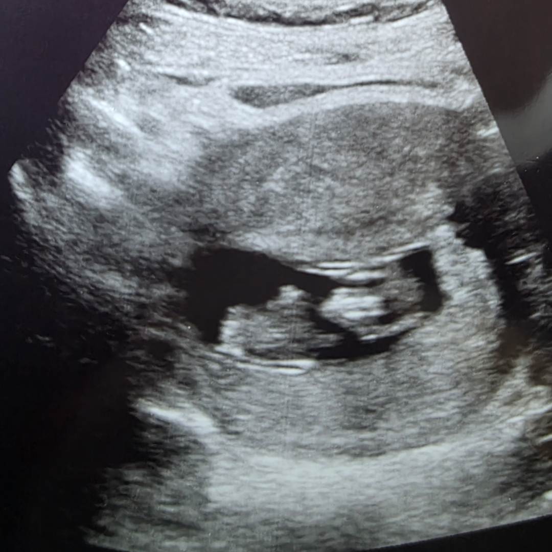 Photo shared by Samantha for their Babylist baby registry.