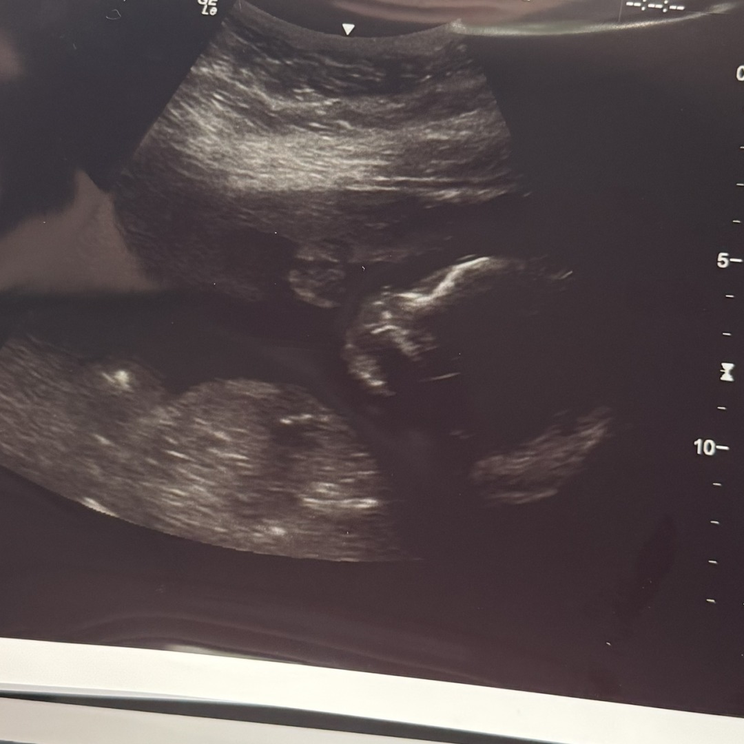 Photo shared by Sky for their Babylist baby registry.