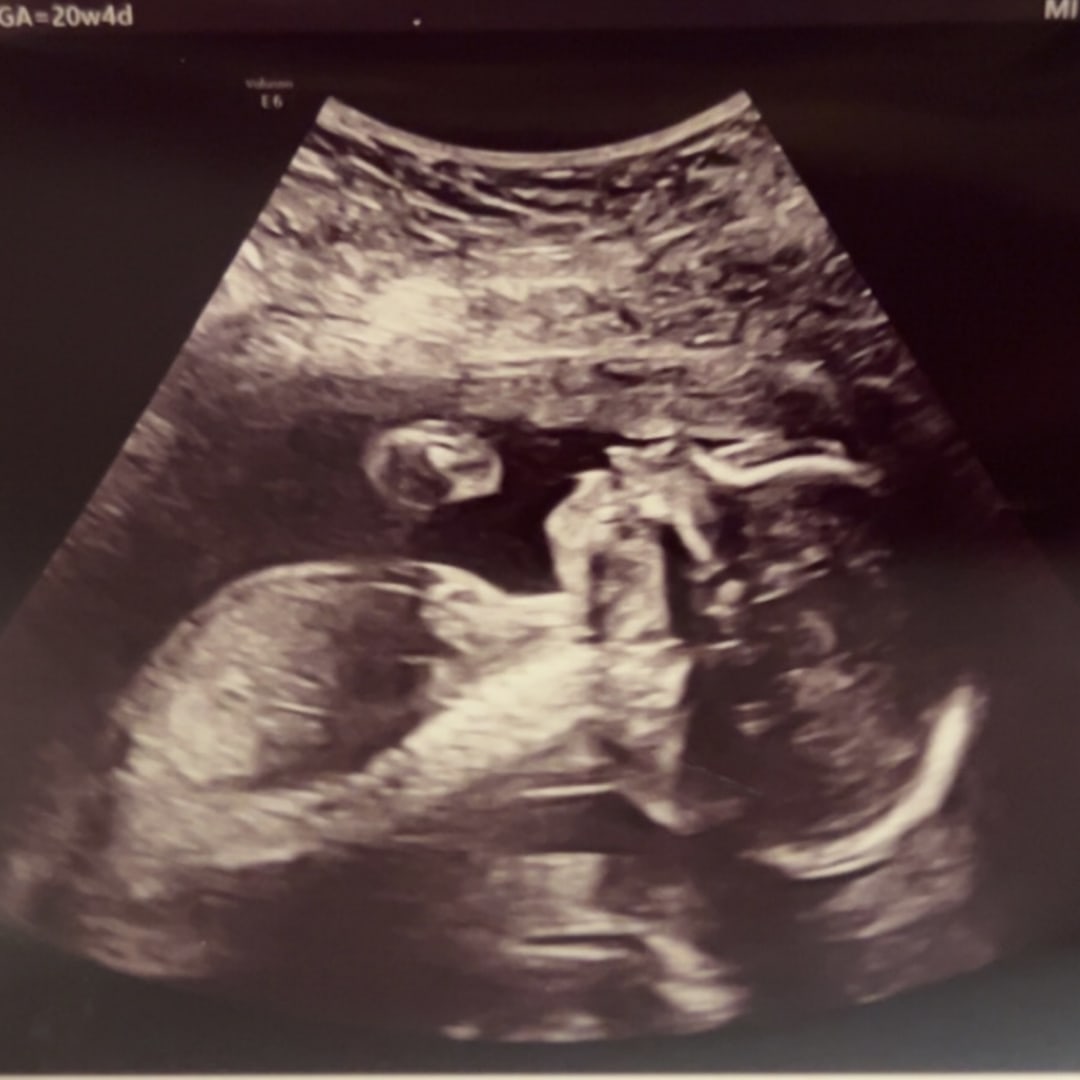 Photo shared by Aubrey for their Babylist baby registry.
