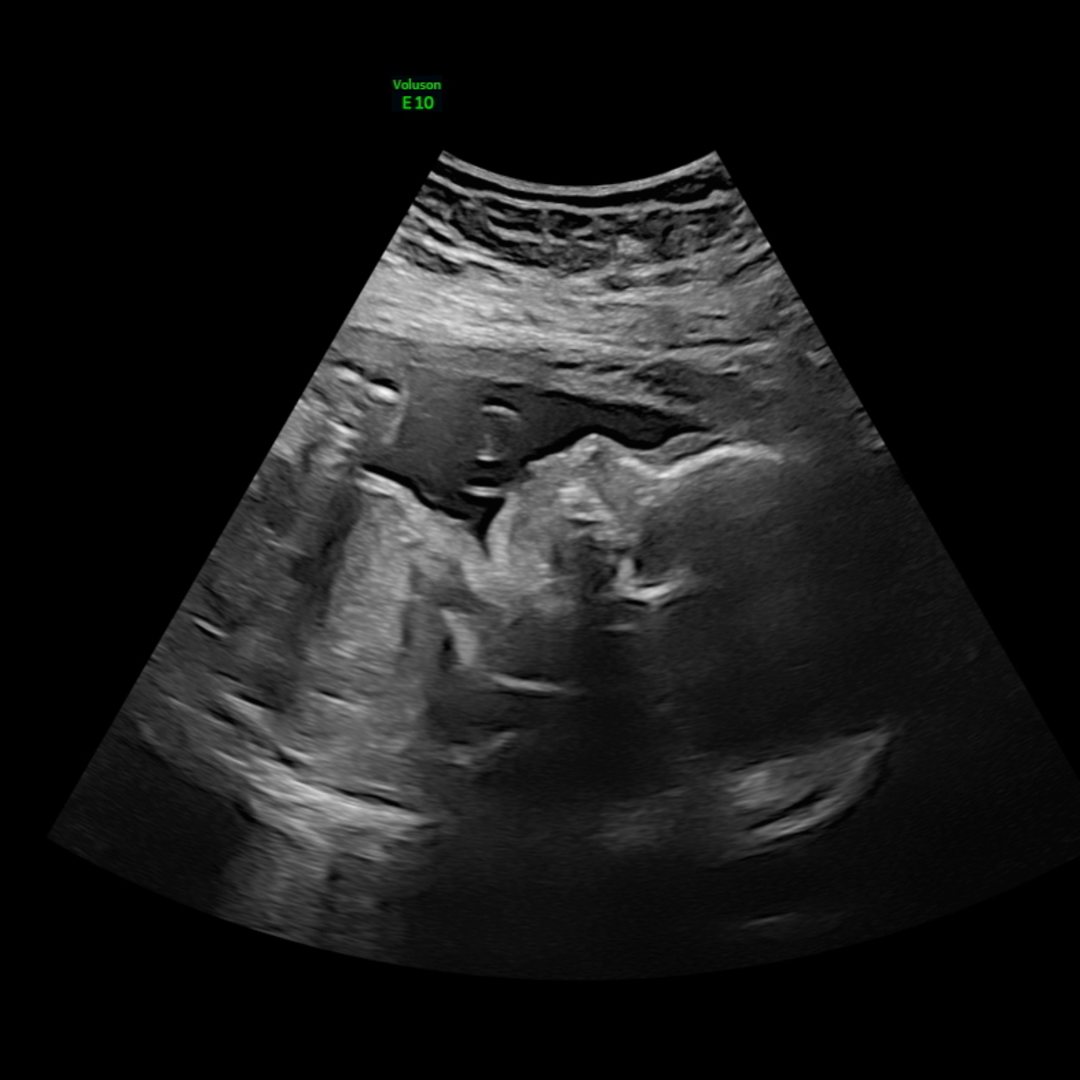 Photo shared by Breana for their Babylist baby registry.