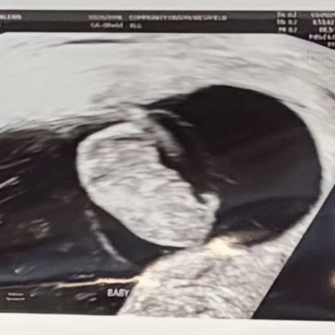 Photo shared by Lexie for their Babylist baby registry.