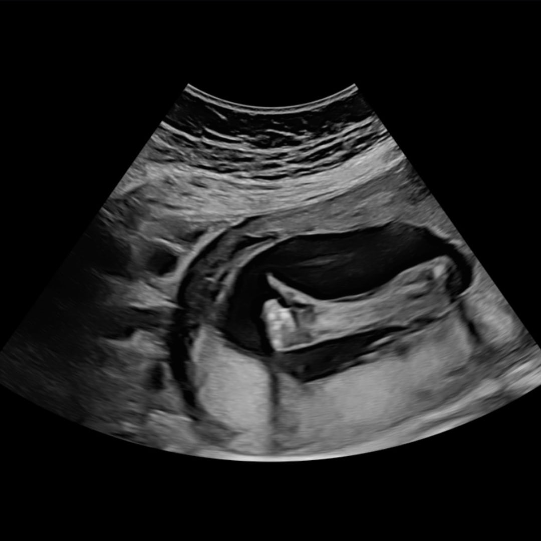 Photo shared by Autumn for their Babylist baby registry.