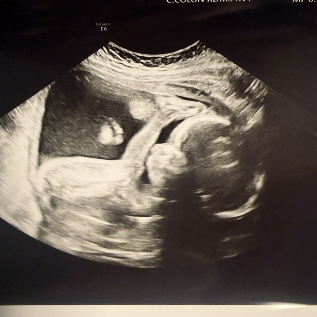 Photo shared by Ashley for their Babylist baby registry.