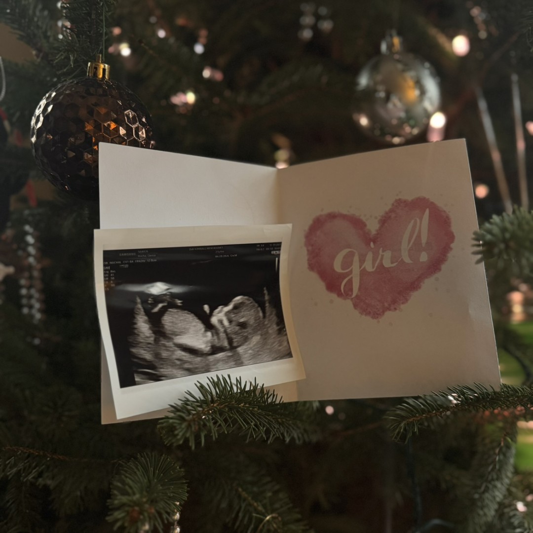 Photo shared by Sierra for their Babylist baby registry.