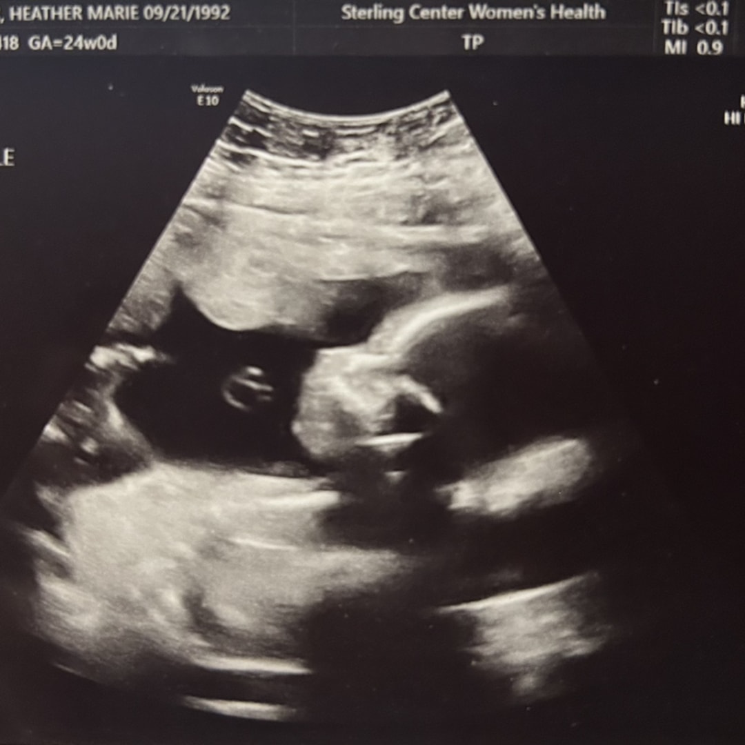 Photo shared by Heather for their Babylist baby registry.