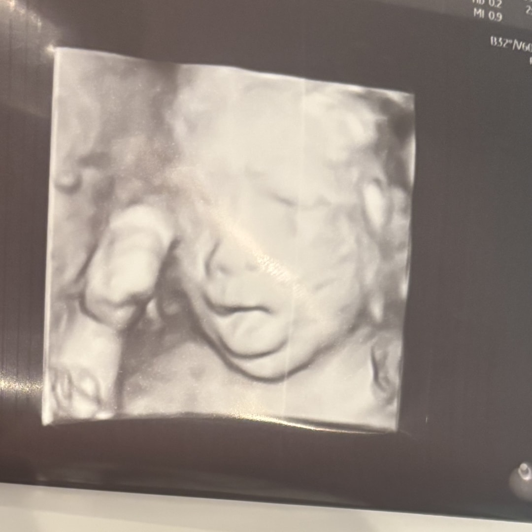 Photo shared by Braeden for their Babylist baby registry.
