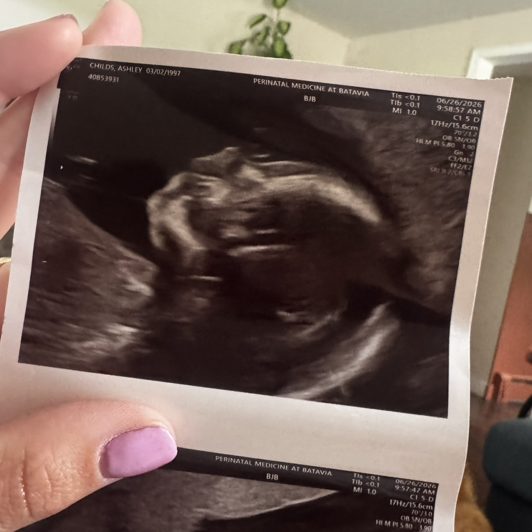 Photo shared by Ashley for their Babylist baby registry.