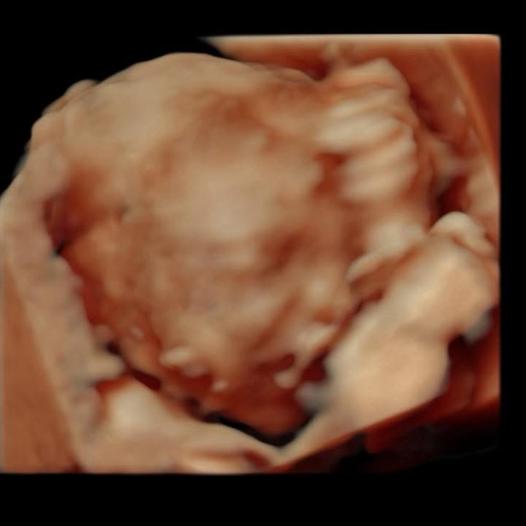 Photo shared by Jennifer for their Babylist baby registry.