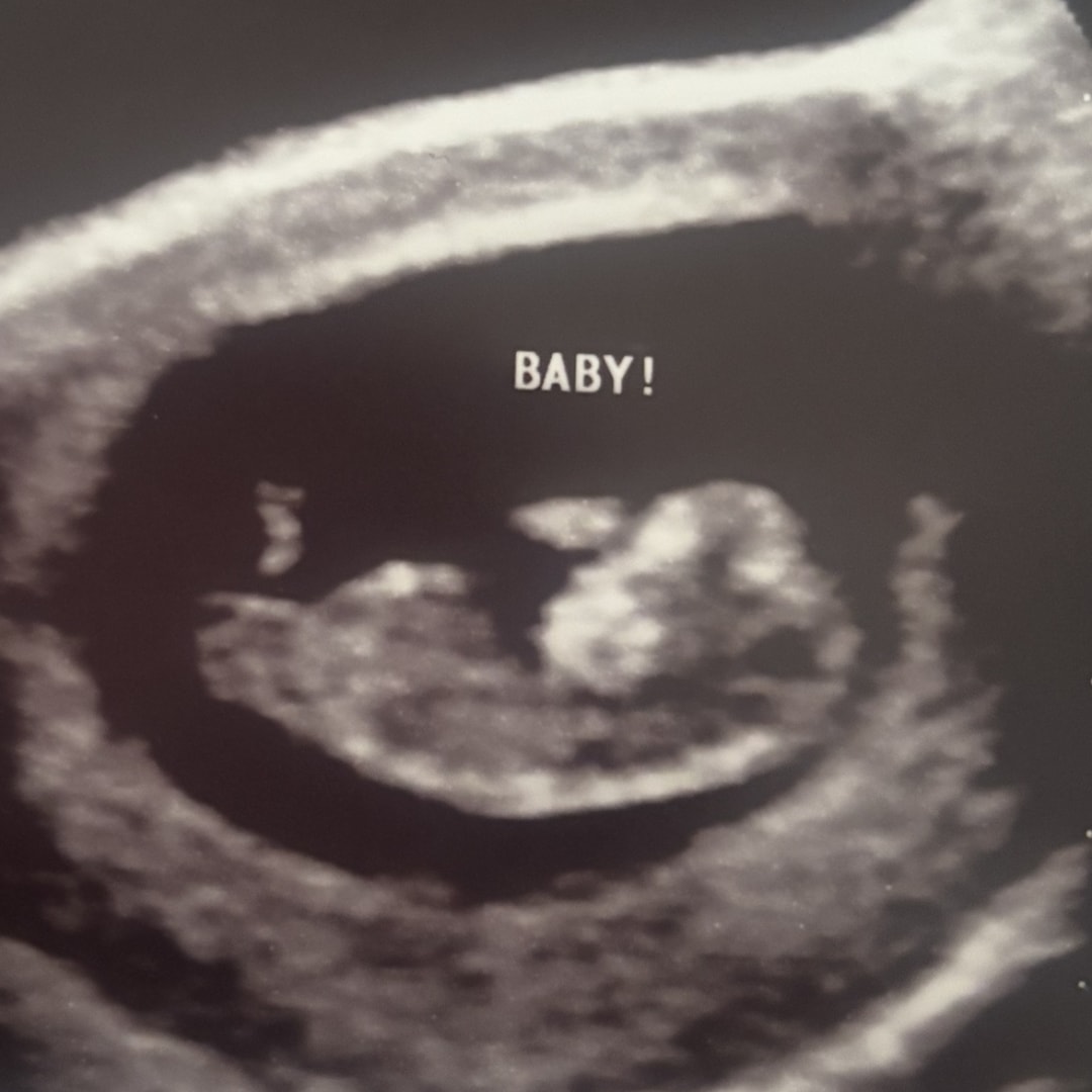 Photo shared by Holly for their Babylist baby registry.