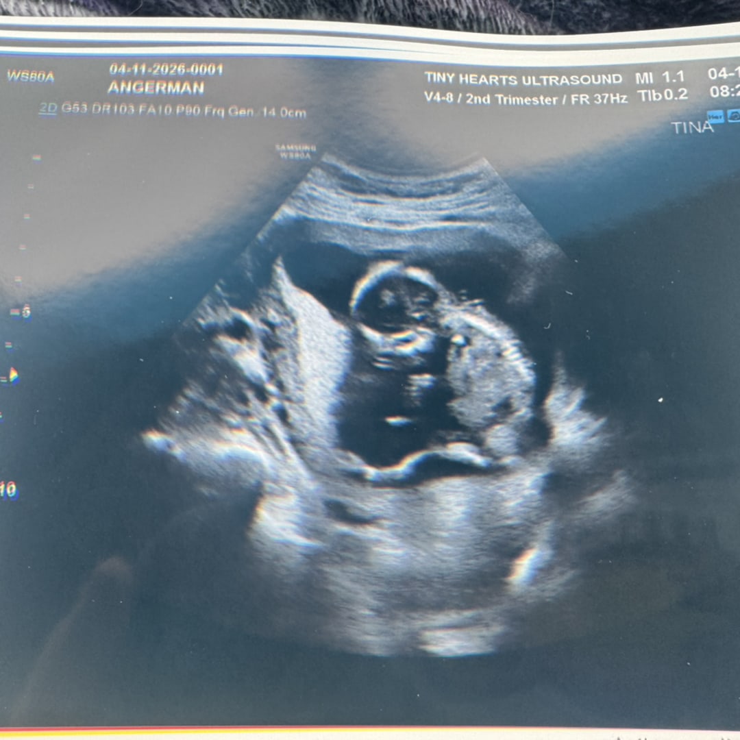 Photo shared by Brittany for their Babylist baby registry.