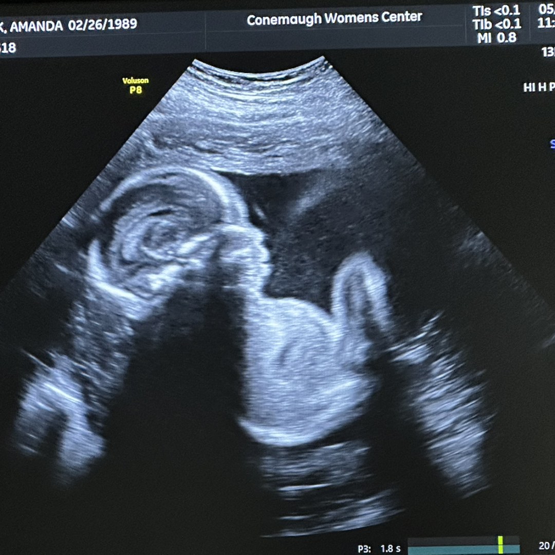 Photo shared by Amanda for their Babylist baby registry.