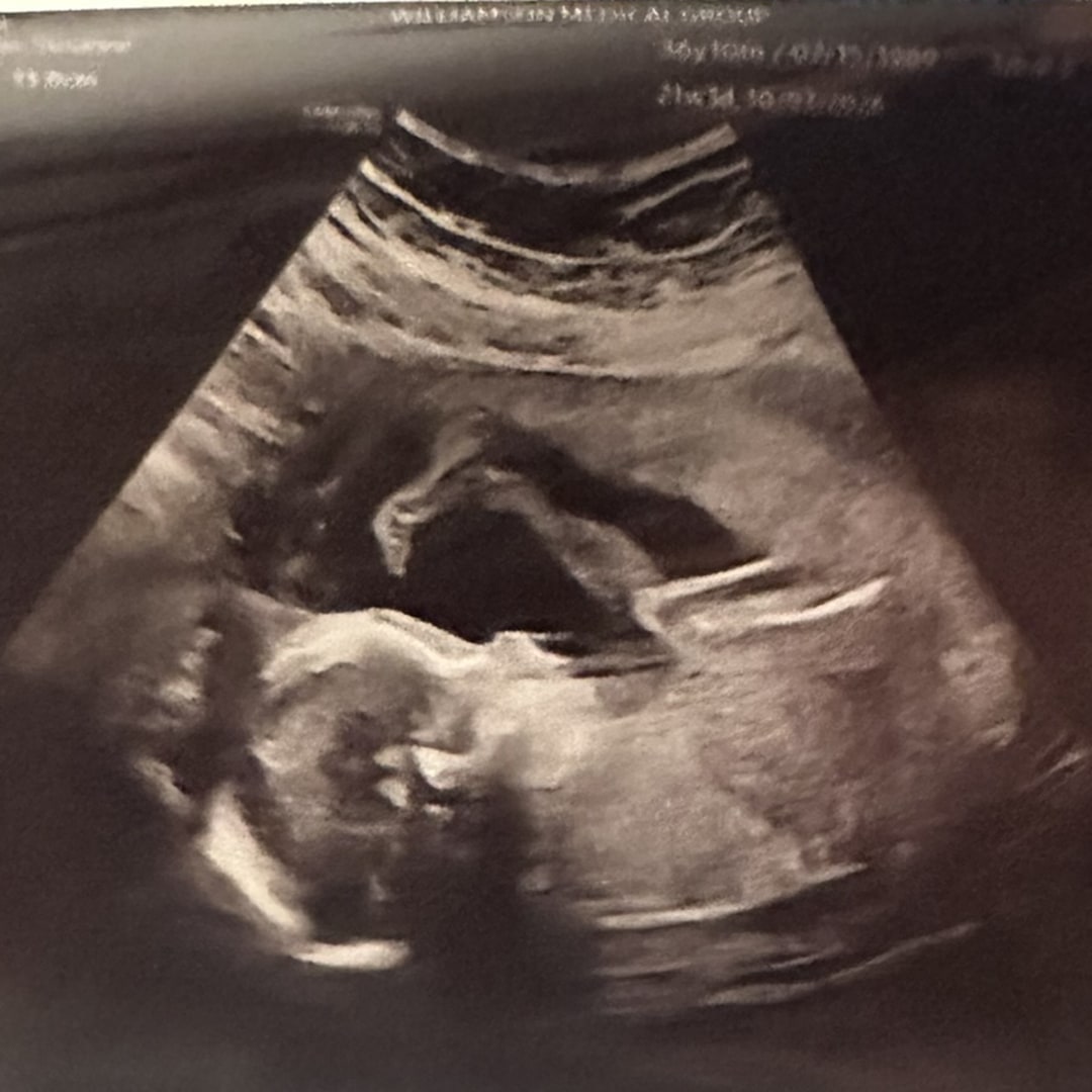 Photo shared by Susanne for their Babylist baby registry.
