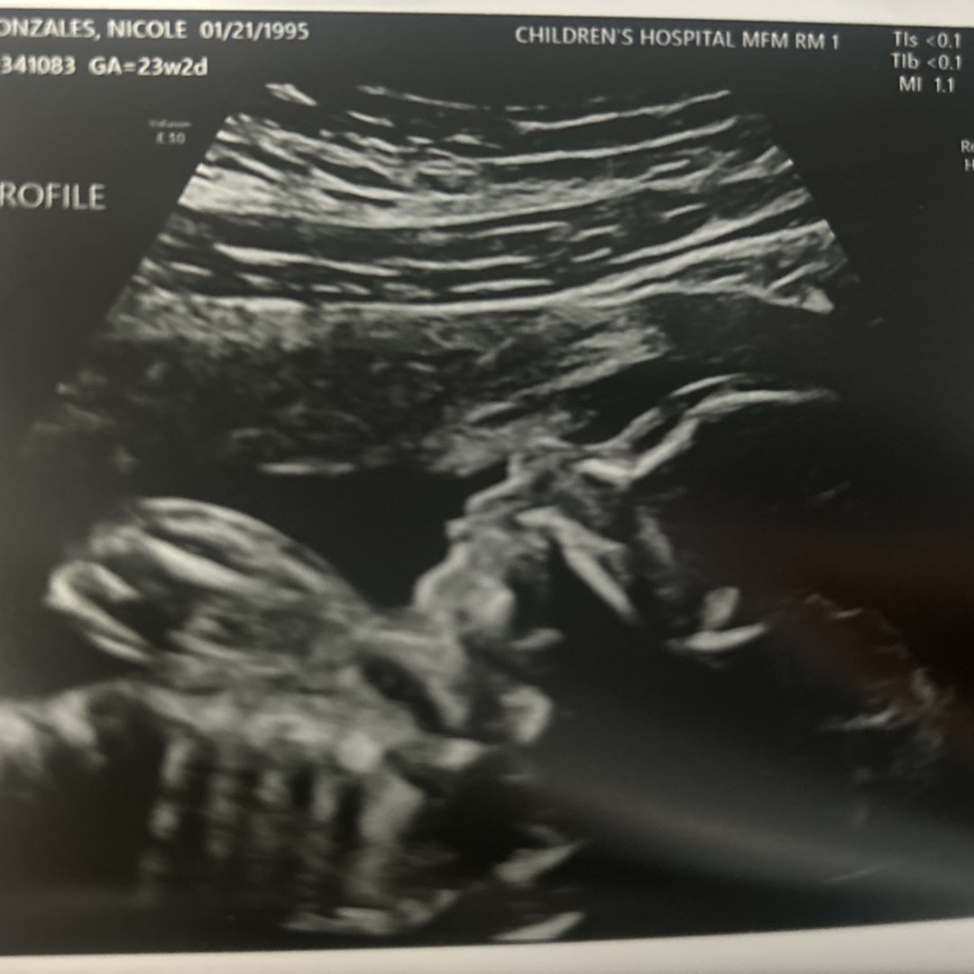 Photo shared by Nikki for their Babylist baby registry.