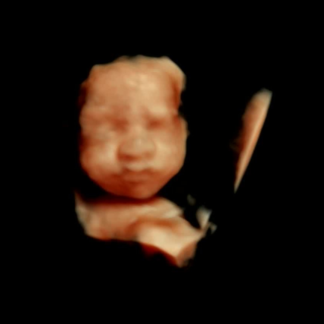 Photo shared by Justine for their Babylist baby registry.