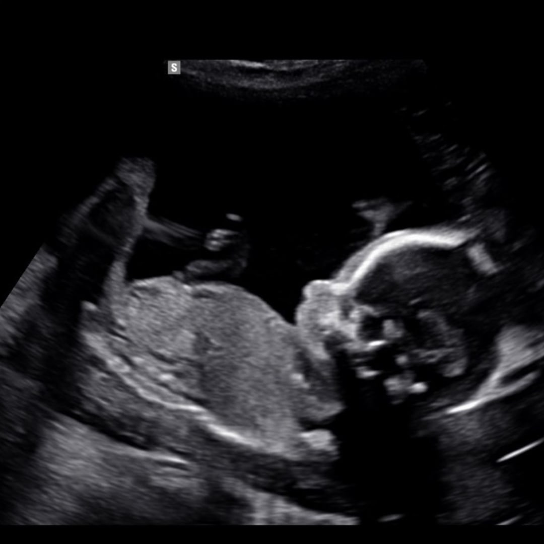 Photo shared by Haven for their Babylist baby registry.