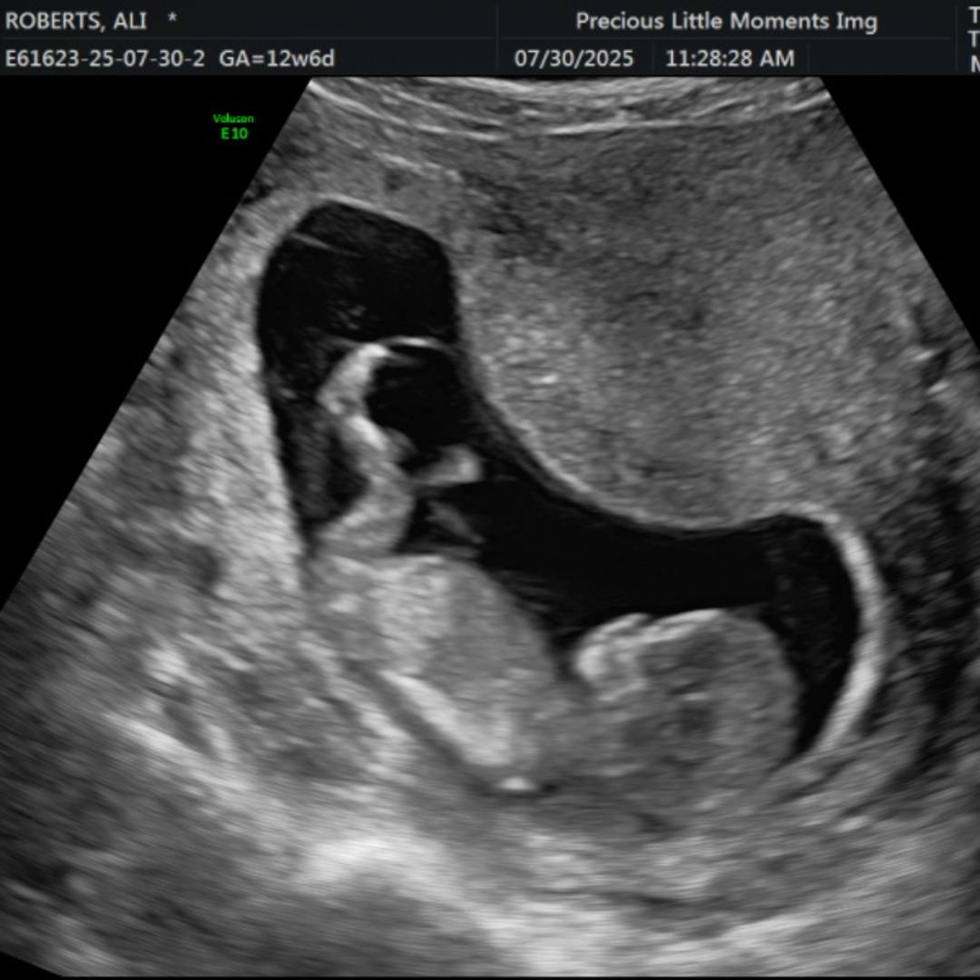 Photo shared by Ali for their Babylist baby registry.