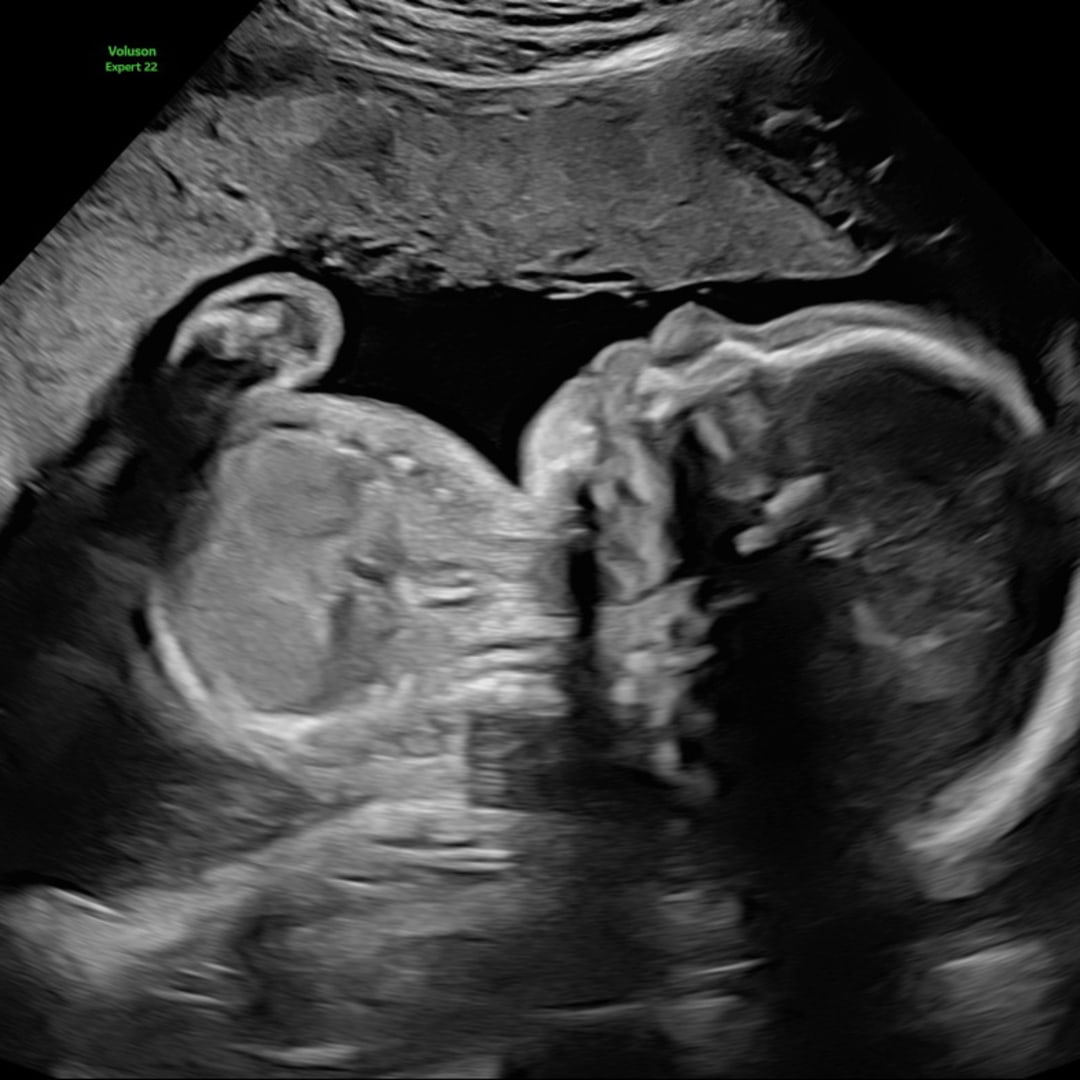 Photo shared by Zaina for their Babylist baby registry.