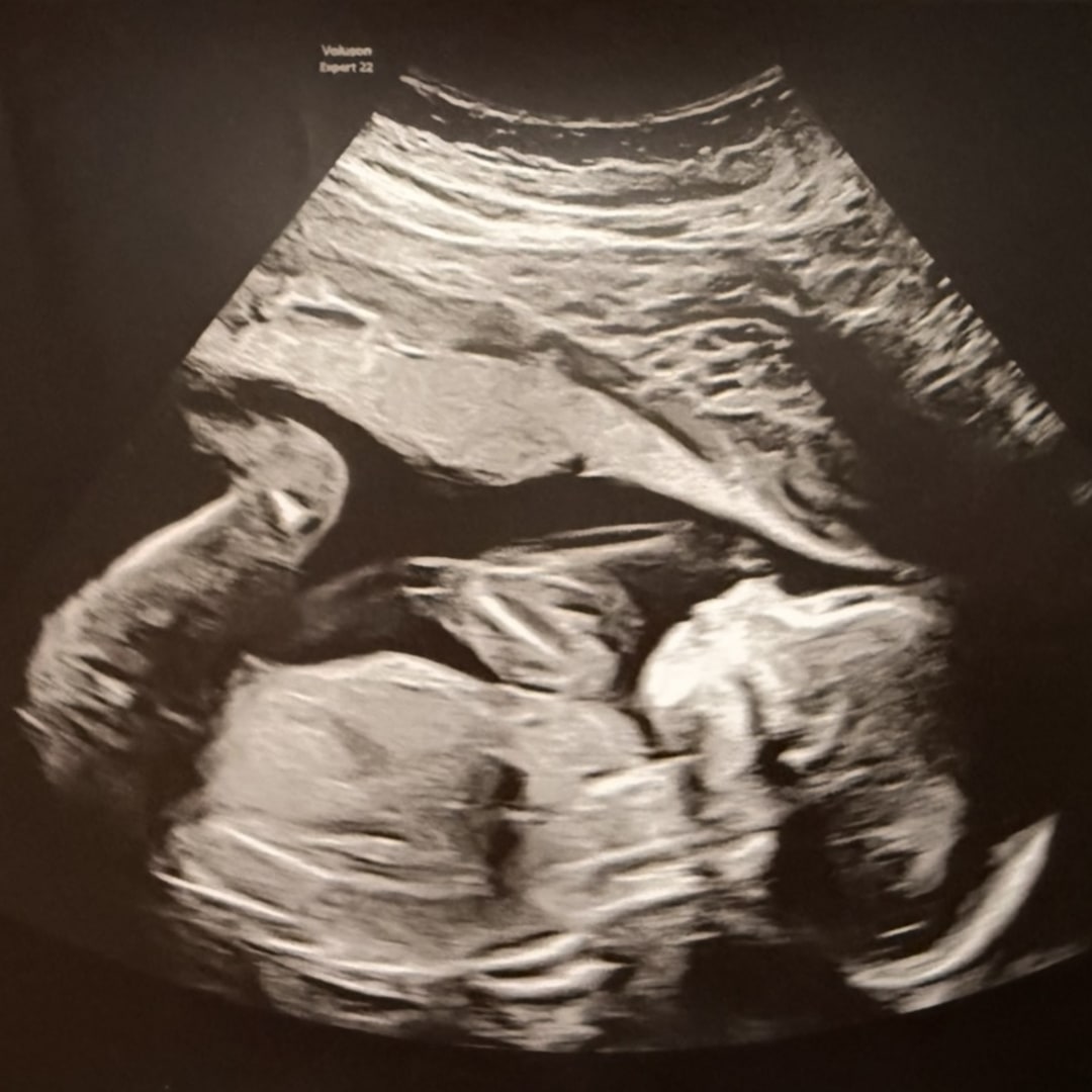 Photo shared by Caitlynne for their Babylist baby registry.