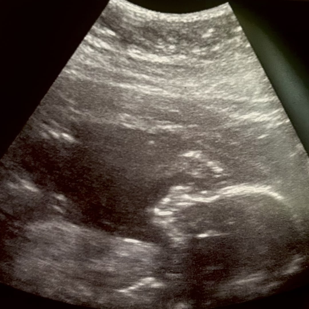 Photo shared by Alyza for their Babylist baby registry.