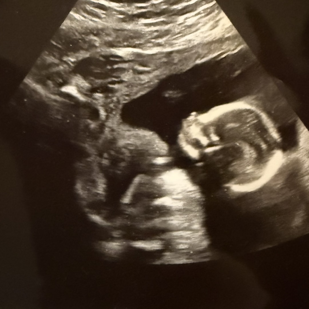Photo shared by Dominique for their Babylist baby registry.