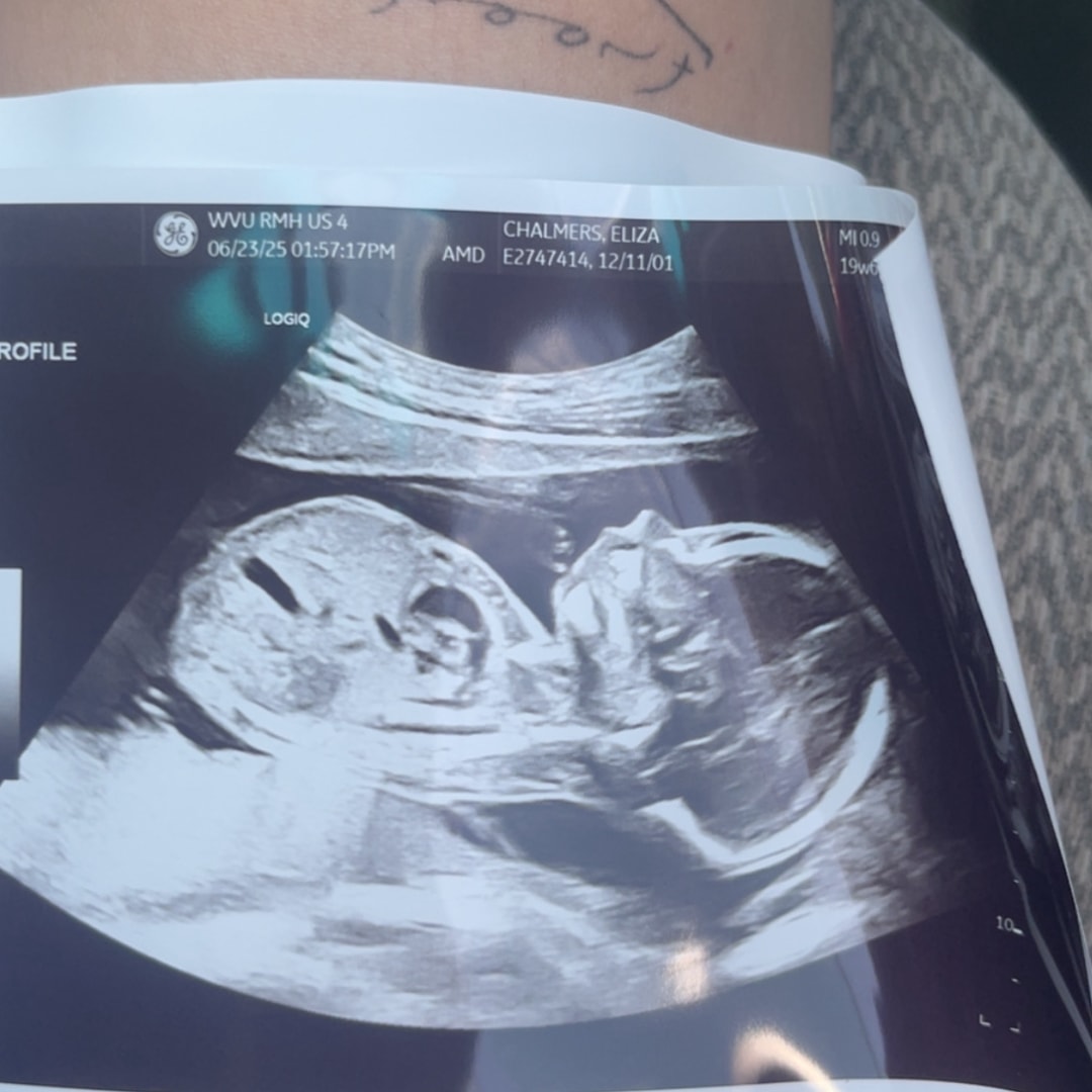 Photo shared by Eliza for their Babylist baby registry.