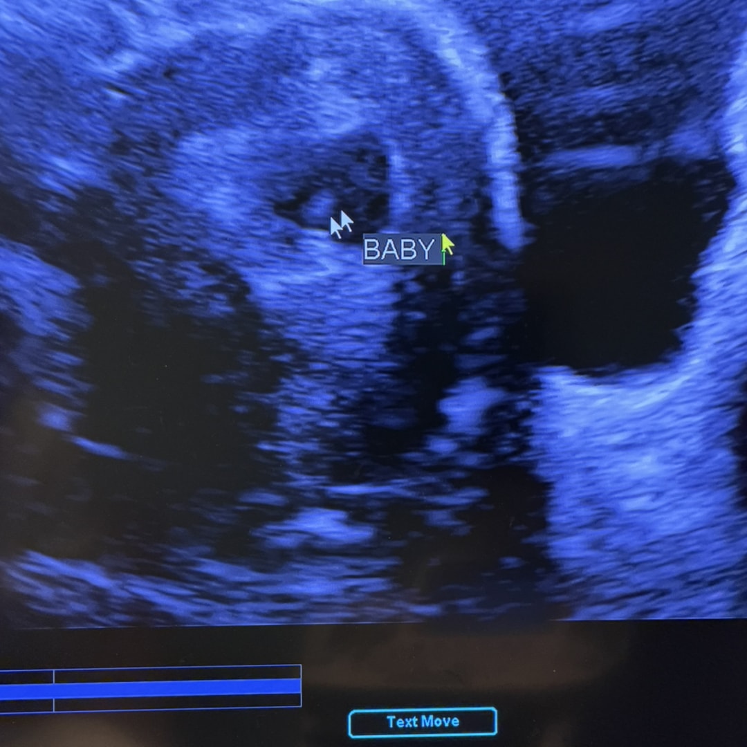 Photo shared by Arian for their Babylist baby registry.