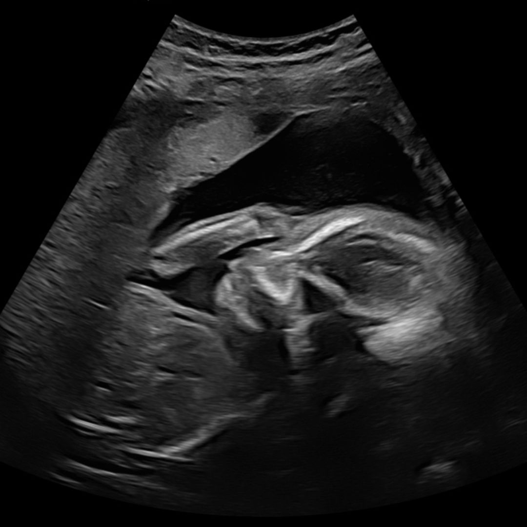 Photo shared by Keli for their Babylist baby registry.