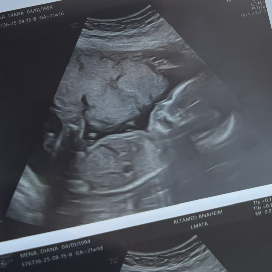 Photo shared by Diana for their Babylist baby registry.